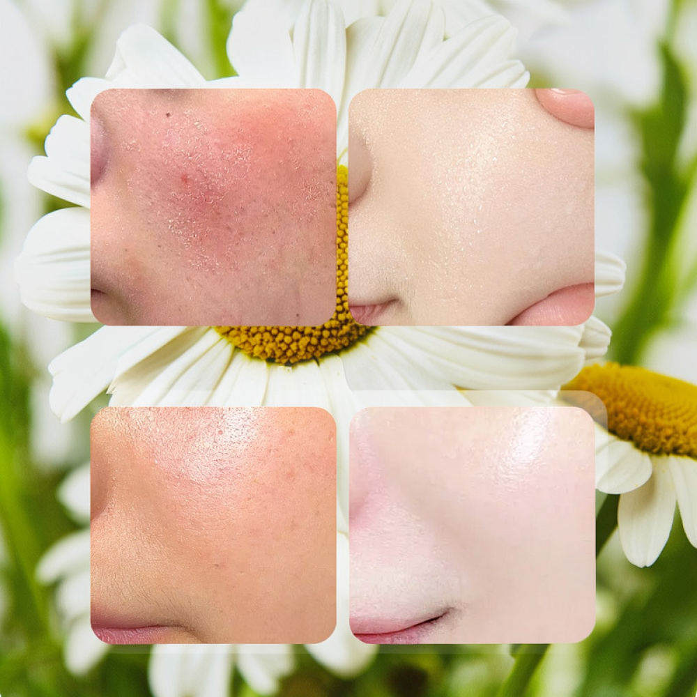 Face Mask Skincare - For Fykly Rose VC Chamomile B5