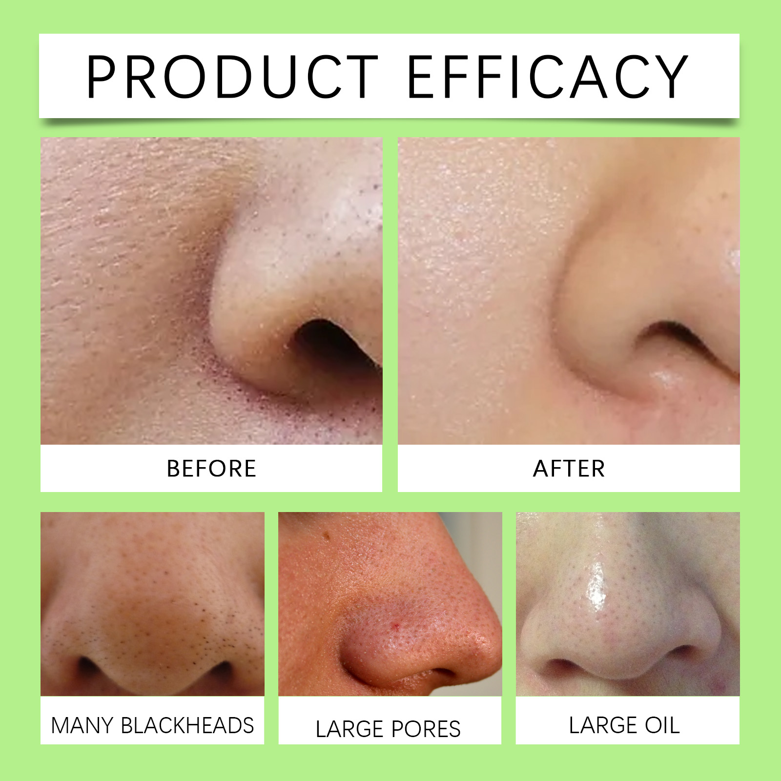 Bamboo Charcoal Nose Strips fo - Cleanser Face review and price
