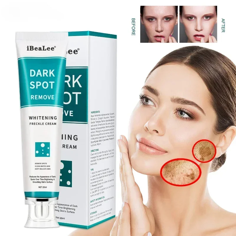 Whitening Freckle Cream Remove - Skincare Glowing review and price