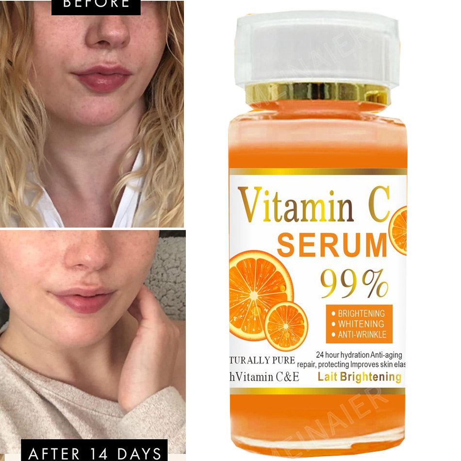 Super 120ml Vitamin C Serum An - Vitamin C Serum review and price