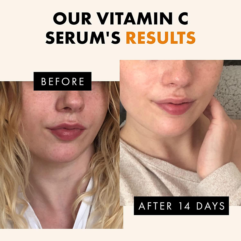 Super 120ml Vitamin C Serum An - Vitamin C Serum review and price